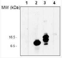 UBQ11 | Ubiquitin (serum) in the group Antibodies Plant/Algal / Protein Modifications / Autophagy-related and Ubiquitin-like Proteins at Agrisera AB (Antibodies for research) (AS08 307)